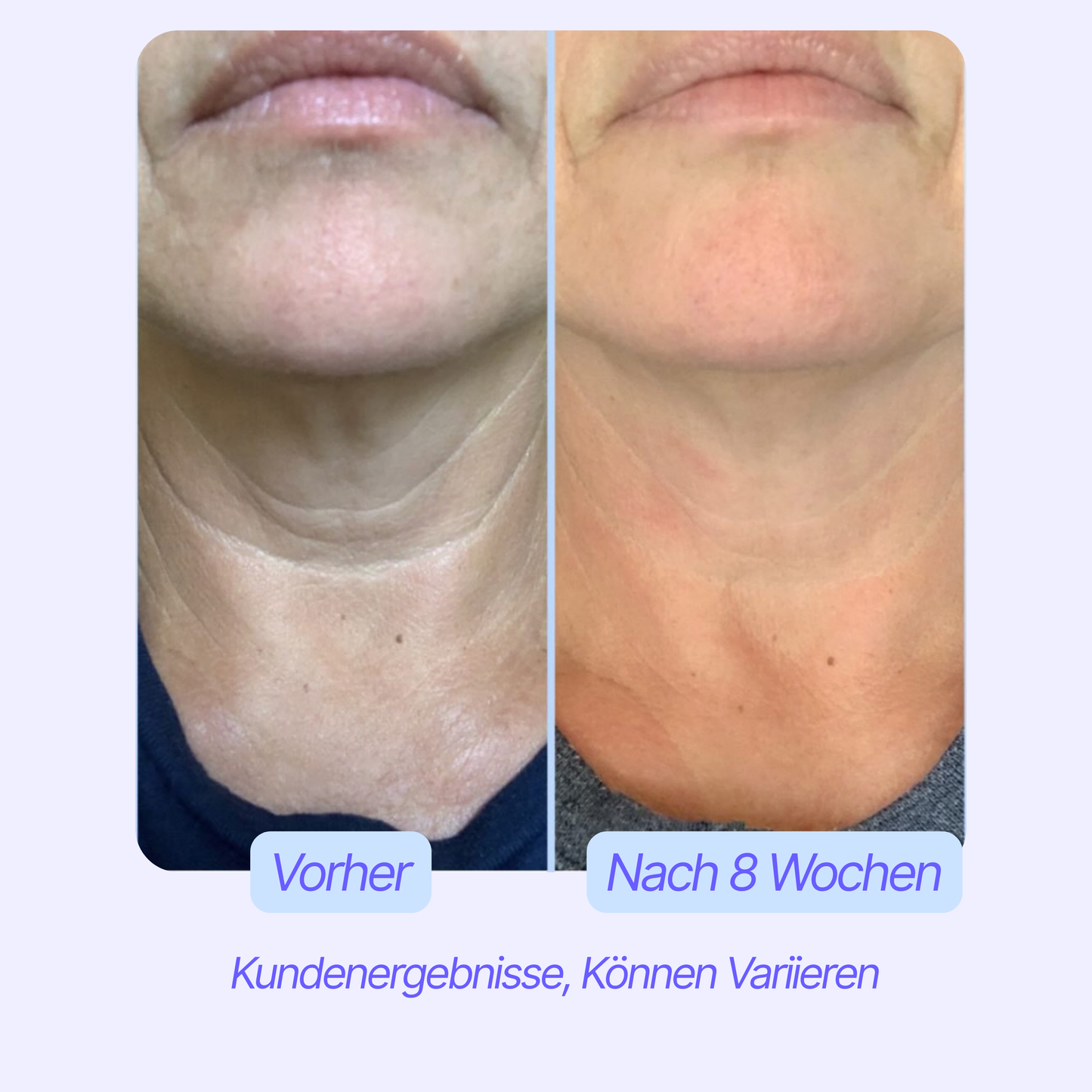 Straffende™ Hals Creme