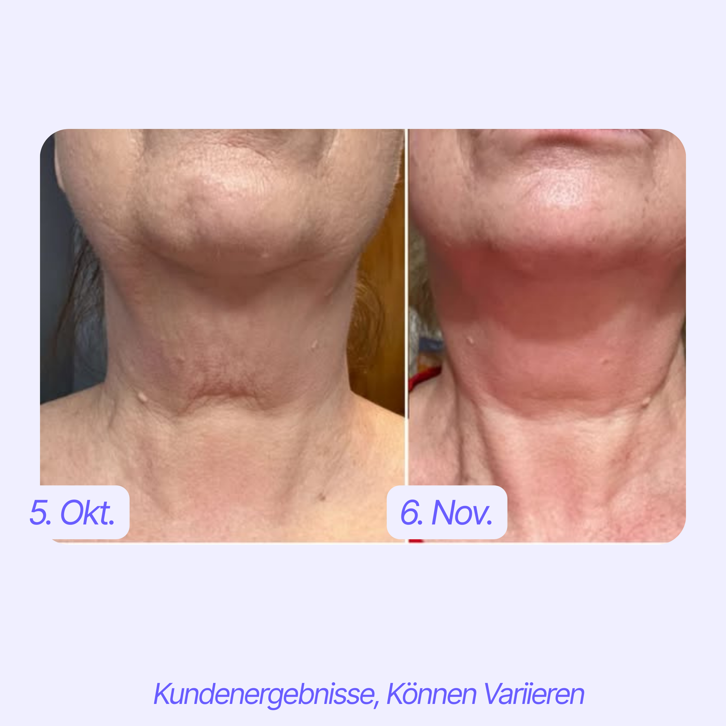 Straffende™ Hals Creme