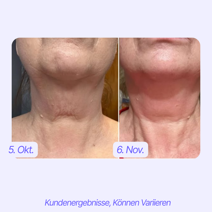 Straffende™ Hals Creme